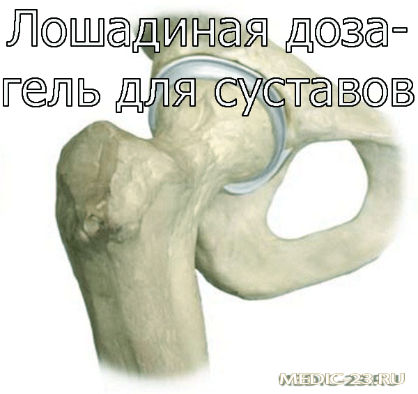 Лошадиная доза-гель для суставов Лошадиная доза-гель для суставов