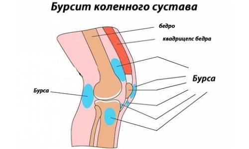 Причины возникновения и симптоматика болезни Причины возникновения и симптоматика болезни