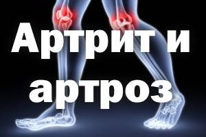 В чем разница между артритом и артрозом