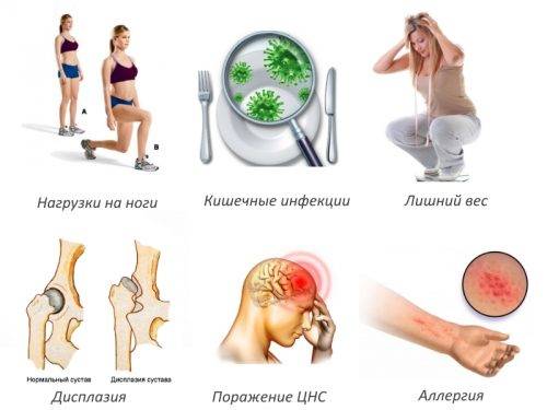 Частые причины артрита