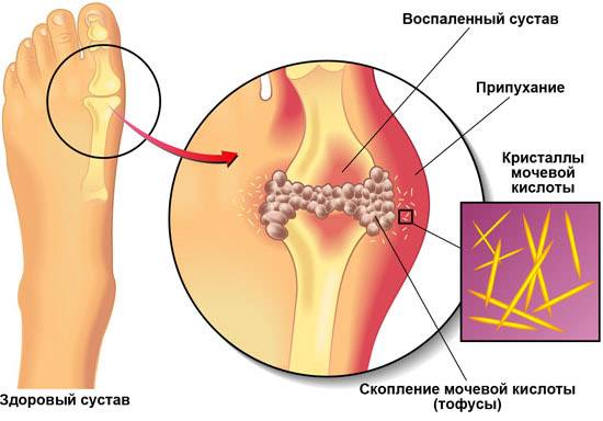 Причины воспаления