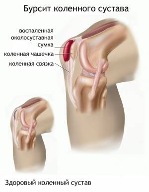 Понятие и виды заболевания
