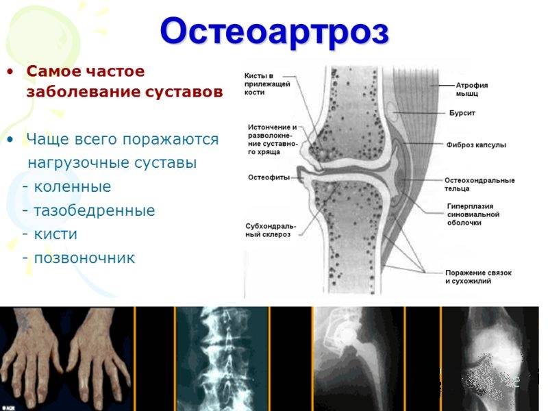 slide_2