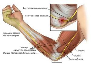 Почему болит локоть