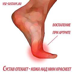 пальцы ног отекают кожа над ними краснеет