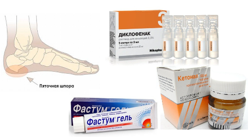 медикаменты для лечения пяточной шпоры