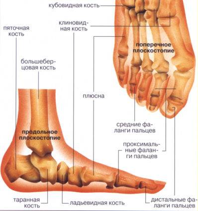 Виды плоскостопия