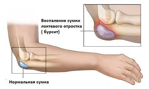 Общие понятия о патологии