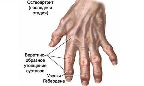 Как избавиться от заболевания? Как избавиться от заболевания?