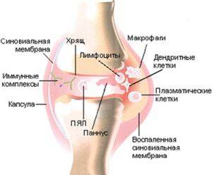 Сустав