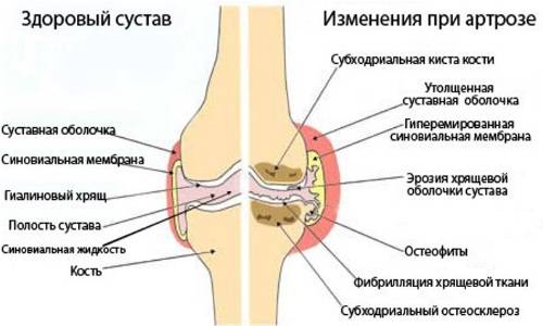 Причины возникновения Причины возникновения