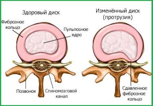 Рисунок показывающих динамику патологии