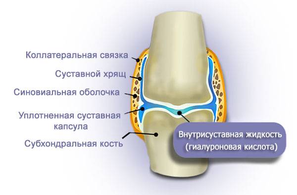 гиалуроновая кислота для суставов