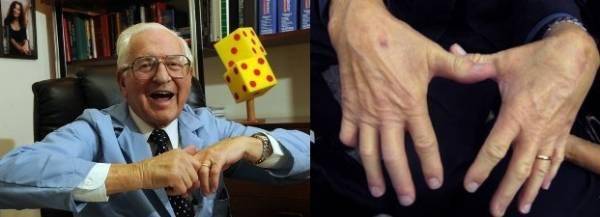 Почему хрустят суставы,почему хрустят суставы во всем теле и в пальцах,почему хрустят колени,тазобедренный сустав,кисти рук,плеча,как лечить