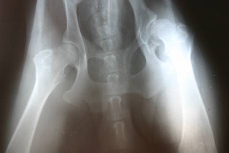 arthritis-picture8