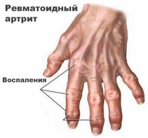 Схема