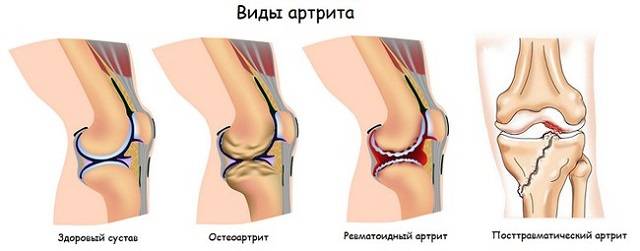 Степени