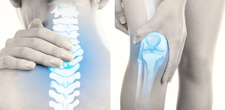 Что такое деформирующий, анкилозирующий, умеренный спондилоартроз?