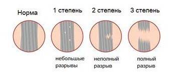 степени растяжения