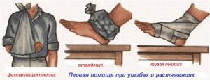 Как выглядит вывих