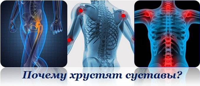 Что делать, если хрустят суставы?