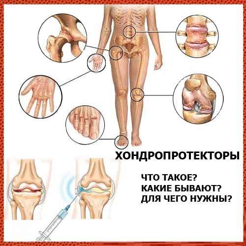 Какие бывают хондропротекторы