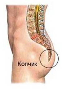 Болезни копчика