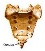 Болезни копчика