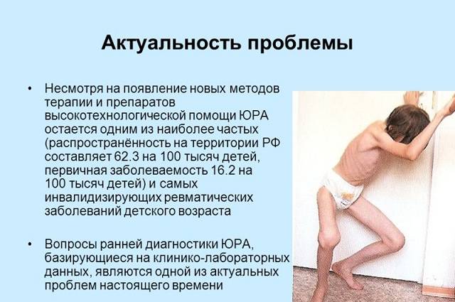 Ювенильный ревматоидный артрит что это такое