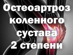 Остеоартроз коленного сустава 2 степени