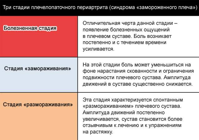 три стадии плечелопаточного периартрита