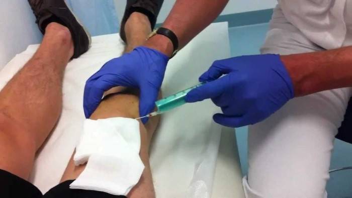 The_puncture_of_the_knee_1-e1430747908116