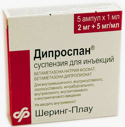 Артроз остеохондроз