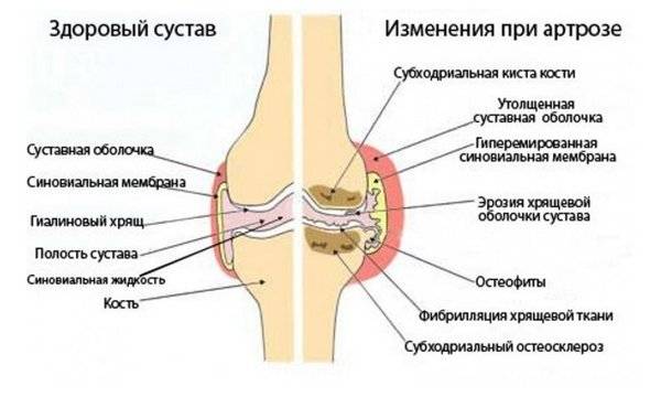 Болят колени