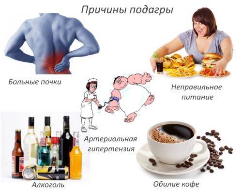 Причины подагры Причины подагры