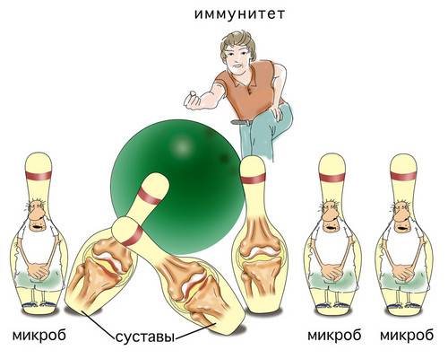 Артрит пальцев рук
