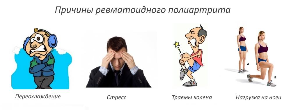 Серонегативный ревматоидный полиартрит