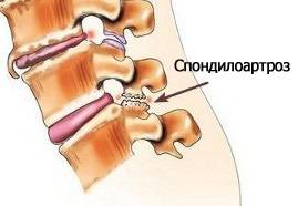 стадии