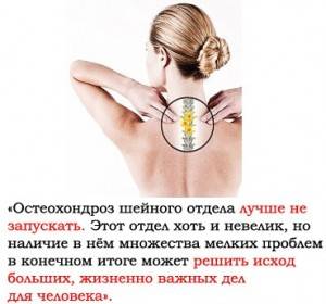 остеохондроз шейного отдела