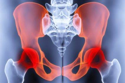 Боль в тазобедренных суставах